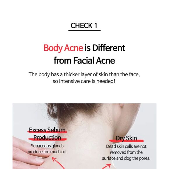 TIA'M, Anti Blemish Body Lotion Back & Chest 200ml - Picture 7 of 12